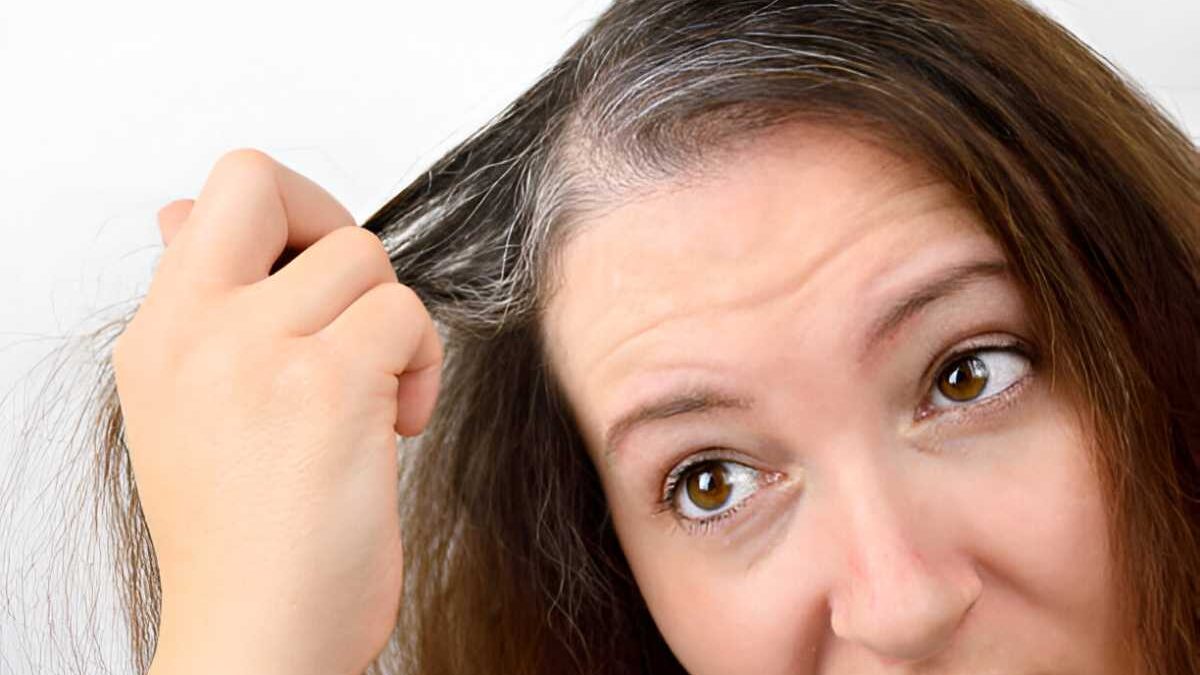 Wellhealthorganic.com/Know The Causes Of White Hair And Easy Ways To Prevent It Naturally