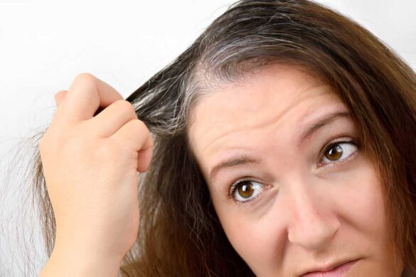 Know The Causes Of White Hair
